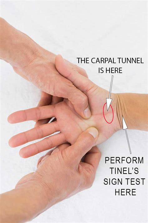 positive test for carpal tunnel